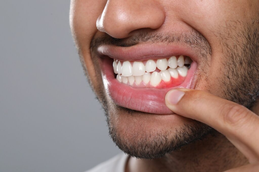 Gum-Disease-Treatment