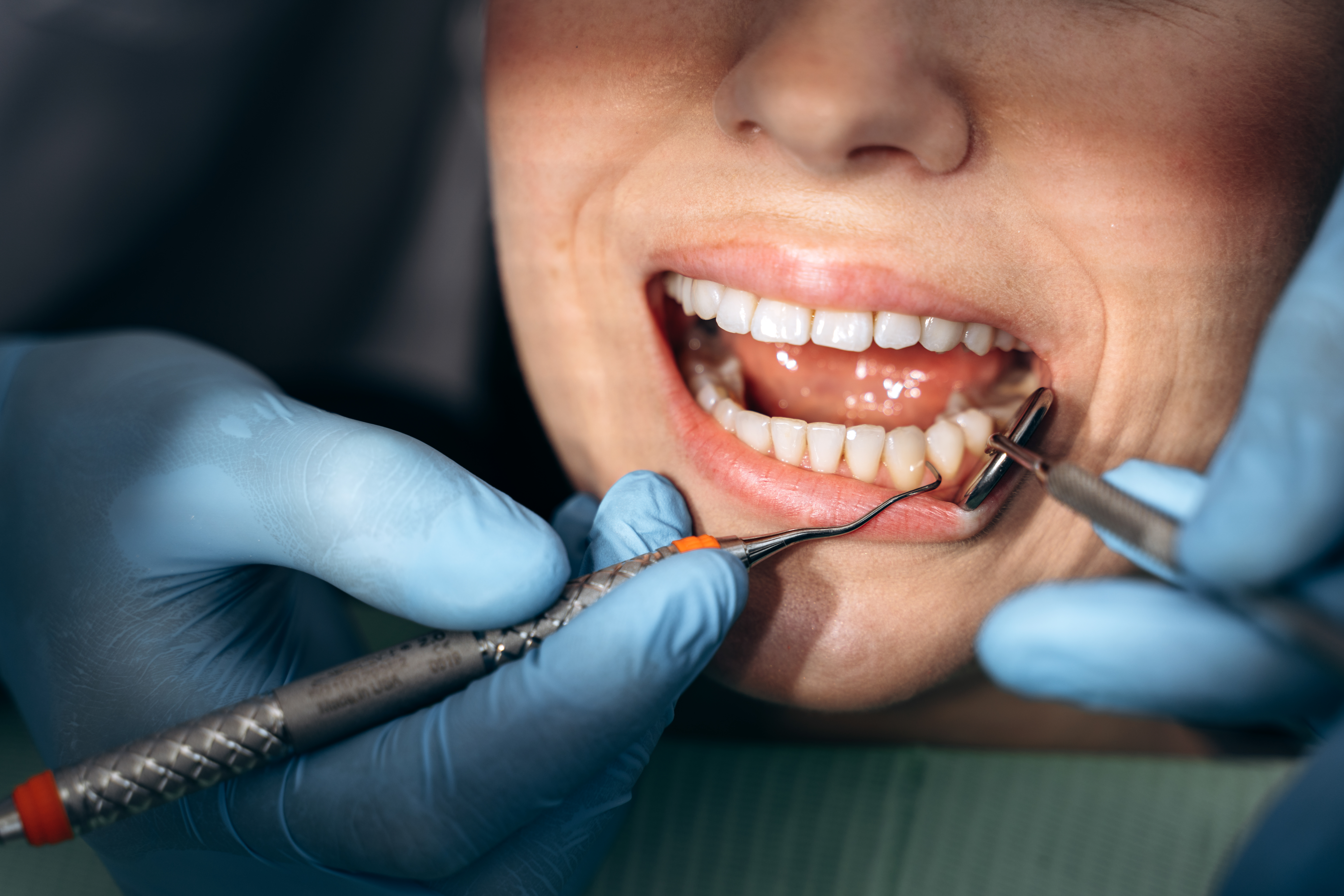 Can Periodontal Disease be Reversed